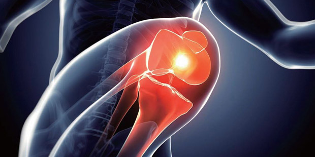 我国关节疾病发病攀升 每年约20万患者置换关节